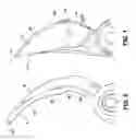 Fig. 04 - Multiple cut zone blade assembly for a hand operated cutting tool