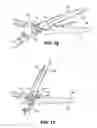Fig. 09 - Multiple cut zone blade assembly for a hand operated cutting tool