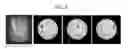 Fig. 09 - Apparatus and method for reconstructing 3D image by using magnetic resonance imaging