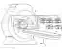 Fig. 01 - Linear phase microstrip radio frequency transmit coils