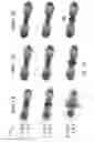 Fig. 14 - Measuring biological tissue parameters using diffusion magnetic resonance imaging
