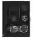 Fig. 16 - Measuring biological tissue parameters using diffusion magnetic resonance imaging