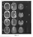 Fig. 20 - Measuring biological tissue parameters using diffusion magnetic resonance imaging