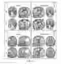Fig. 28 - Measuring biological tissue parameters using diffusion magnetic resonance imaging