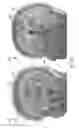 Fig. 29 - Measuring biological tissue parameters using diffusion magnetic resonance imaging