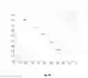 Fig. 11 - Technique for video quality estimation