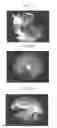 Fig. 06 - Image processing device, image processing method, and program for image processing for correcting displacement between pictures obtained by temporally-continuous capturing