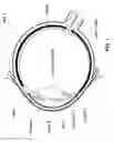 Fig. 02 - Image-processor-controlled misalignment-reduction for ophthalmic systems