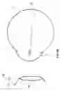 Fig. 05 - Image-processor-controlled misalignment-reduction for ophthalmic systems