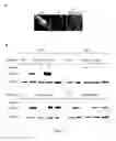 Fig. 07 - Inhibition of the interaction between 5T4 oncofoetal glycoproteins and CXC chemokine receptors as a method of identifying chemotaxis inhibitors
