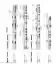 Fig. 45 - Neutralizing antibodies to HIV-1 and their use