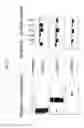 Fig. 06 - Recombinant dengue virus antigen comprising the capsid protein leader sequence, full-length prM protein, and full-length E protein