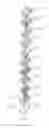 Fig. 02 - Multi-Layered Decorative Object and Methods