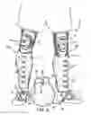 Fig. 04 - Soccer training device