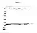 Fig. 02 - MODIFIED PORCINE SOMATOTROPIN POLYPEPTIDES AND THEIR USES