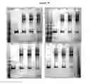 Fig. 35 - MODIFIED PORCINE SOMATOTROPIN POLYPEPTIDES AND THEIR USES