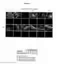 Fig. 02 - METHOD OF TREATING CONDITIONS ASSOCIATED WITH AIRWAY TISSUE REMODELING