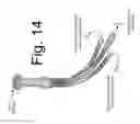 Fig. 15 - METHOD AND APPARATUS TO DETECT CORONARY ARTERY CALCIFICATION OR DISEASE