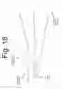 Fig. 19 - METHOD AND APPARATUS TO DETECT CORONARY ARTERY CALCIFICATION OR DISEASE