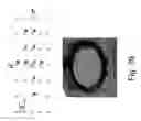 Fig. 44 - METHOD AND APPARATUS TO DETECT CORONARY ARTERY CALCIFICATION OR DISEASE