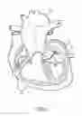 Fig. 02 - Sensor assembly tethered within catheter wall