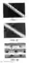 Fig. 02 - Echogenically Enhanced Device