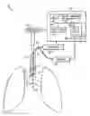 Fig. 01 - Multiple channel tracheal tube placement device and technique for using the same