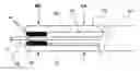 Fig. 01 - APPARATUS AND METHOD FOR GUIDED CHRONIC TOTAL OCCLUSION PENETRATION