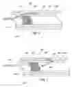 Fig. 03 - Device and method for vascular re-entry
