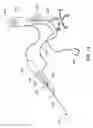 Fig. 08 - Device and method for vascular re-entry