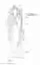 Fig. 06 - Intravascular access catheter