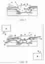 Fig. 02 - METHOD AND APPARATUS FOR WOUND TREATMENT