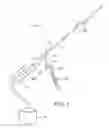 Fig. 02 - Apparatus and methods for clot dissolution