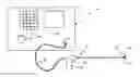 Fig. 01 - Method and device for tissue fusion or coagulation by an electrical action with negative source impedance