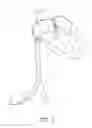 Fig. 02 - Suturing devices and methods for closing a patent foramen ovale