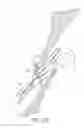 Fig. 18 - Suturing devices and methods for closing a patent foramen ovale