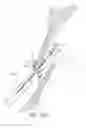 Fig. 20 - Suturing devices and methods for closing a patent foramen ovale
