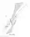 Fig. 32 - Suturing devices and methods for closing a patent foramen ovale