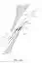 Fig. 60 - Suturing devices and methods for closing a patent foramen ovale
