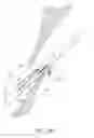 Fig. 63 - Suturing devices and methods for closing a patent foramen ovale