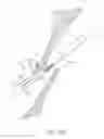 Fig. 65 - Suturing devices and methods for closing a patent foramen ovale