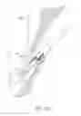 Fig. 69 - Suturing devices and methods for closing a patent foramen ovale