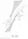 Fig. 83 - Suturing devices and methods for closing a patent foramen ovale