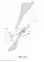 Fig. 85 - Suturing devices and methods for closing a patent foramen ovale
