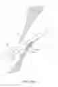 Fig. 86 - Suturing devices and methods for closing a patent foramen ovale
