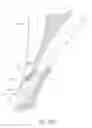 Fig. 87 - Suturing devices and methods for closing a patent foramen ovale