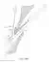 Fig. 89 - Suturing devices and methods for closing a patent foramen ovale