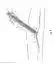Fig. 09 - Tissue closure and tissue closing device