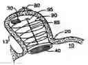 Fig. 01 - BARRIER DEVICE FOR OSTIUM OF LEFT ATRIAL APPENDAGE