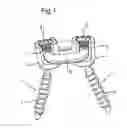 Fig. 02 - Dynamic stabilization device for bones or vertebrae